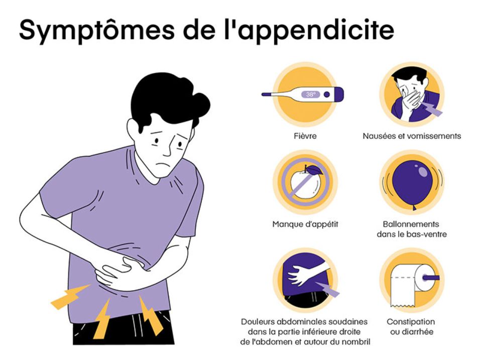 Appendicite que faire en cas d